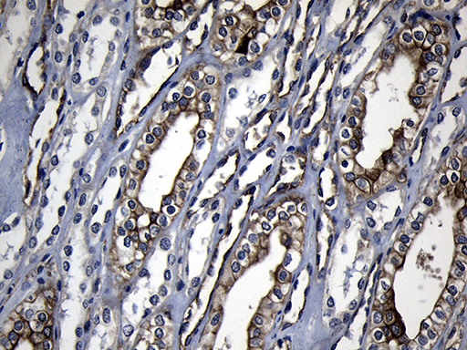 m01978 1 anti rrm2 mouse monoclonal antibody clone id oti3d3 ihc testing 6