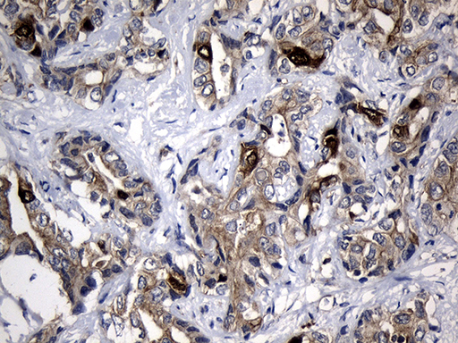 m01978 1 anti rrm2 mouse monoclonal antibody clone id oti3d3 ihc testing 7