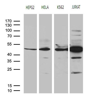 Western blot analysis of extracts (35ug) from 4 different cell lines by using anti-RRM2 monoclonal antibody (1:500)