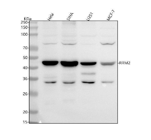  Western blot analysis of RRM2 using anti-RRM2 antibody (M01978)