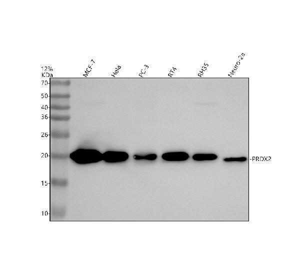 m01982 prdx2 primary antibodies wb testing 1