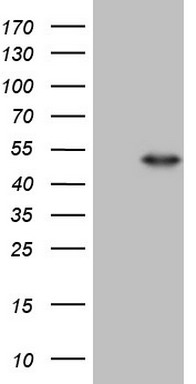 HEK293T cells were transfected with the pCMV6-ENTRY control (Left lane) or pCMV6-ENTRY NR2E3 (Right lane) cDNA for 48 hrs and lysed