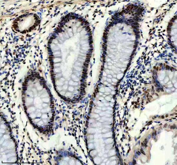 m01985 1 prox1 primary antibodies ihc testing 2