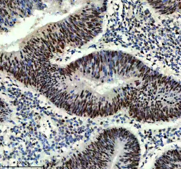 IHC analysis of PROX1 using anti-PROX1 antibody (M01985-1)
