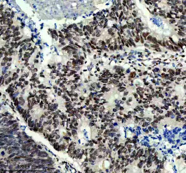 IHC analysis of PROX1 using anti-PROX1 antibody (M01985-1)