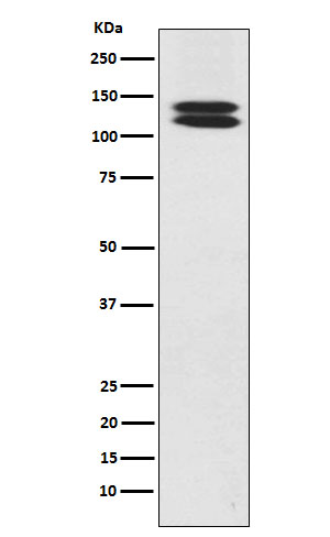 Western blot analysis of H Cadherin expression in Human fetal heart lysate