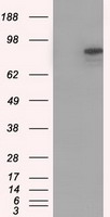 HEK293T cells were transfected with the pCMV6-ENTRY control (Left lane) or pCMV6-ENTRY CDH13 (Right lane) cDNA for 48 hrs and lysed