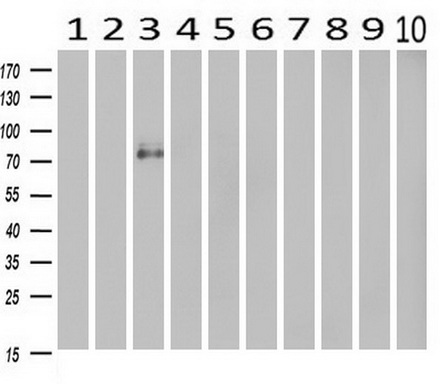 Western blot analysis of extracts (10ug) from 10 Human tissue by using anti-CDH13 monoclonal antibody at 1:500 (1: Testis; 2: Omentum; 3: Uterus; 4: Breast; 5: Brain; 6: Liver; 7: Ovary; 8: Thyroid gland; 9: colon;10: spleen)