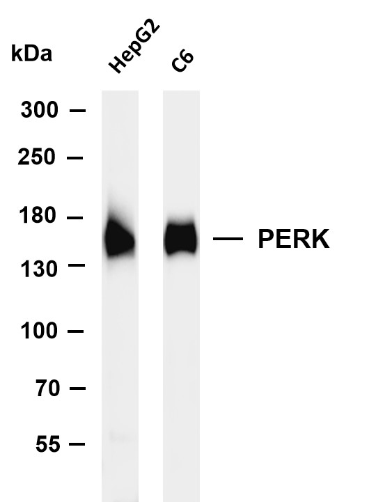 Various whole cell lysates were separated by 4-8% SDS-PAGE, and the membrane was blotted with anti-PERK antibody