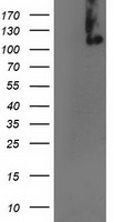 HEK293T cells were transfected with the pCMV6-ENTRY control (Left lane) or pCMV6-ENTRY ERCC4 (Right lane) cDNA for 48 hrs and lysed