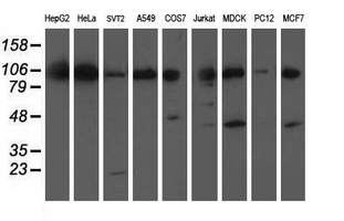Western blot analysis of extracts (35ug) from 9 different cell lines by using anti-ERCC4 monoclonal antibody
