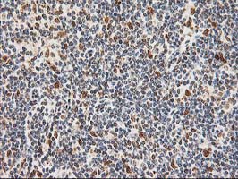 m01993 anti xpf ercc4 mouse monoclonal antibody clone id oti4e11 ihc testing 10