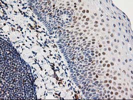 m01993 anti xpf ercc4 mouse monoclonal antibody clone id oti4e11 ihc testing 11