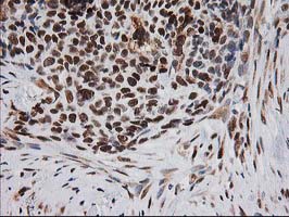 m01993 anti xpf ercc4 mouse monoclonal antibody clone id oti4e11 ihc testing 12