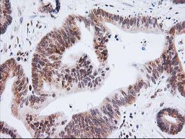 m01993 anti xpf ercc4 mouse monoclonal antibody clone id oti4e11 ihc testing 13