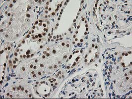 m01993 anti xpf ercc4 mouse monoclonal antibody clone id oti4e11 ihc testing 14