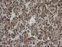 m01993 anti xpf ercc4 mouse monoclonal antibody clone id oti4e11 ihc testing 15