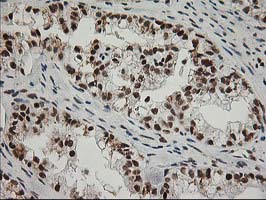 m01993 anti xpf ercc4 mouse monoclonal antibody clone id oti4e11 ihc testing 4