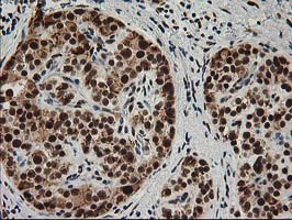 m01993 anti xpf ercc4 mouse monoclonal antibody clone id oti4e11 ihc testing 5
