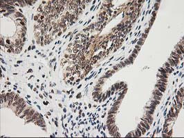 m01993 anti xpf ercc4 mouse monoclonal antibody clone id oti4e11 ihc testing 6