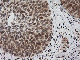 m01993 anti xpf ercc4 mouse monoclonal antibody clone id oti4e11 ihc testing 9