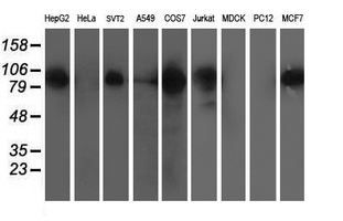 Western blot analysis of extracts (35ug) from 9 different cell lines by using anti-ERCC4 monoclonal antibody