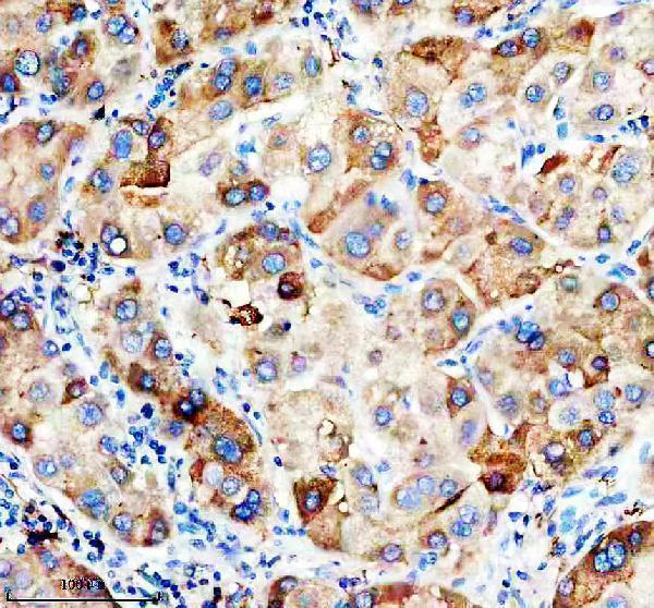 IHC analysis of APOH using anti-APOH antibody (M01998-1)