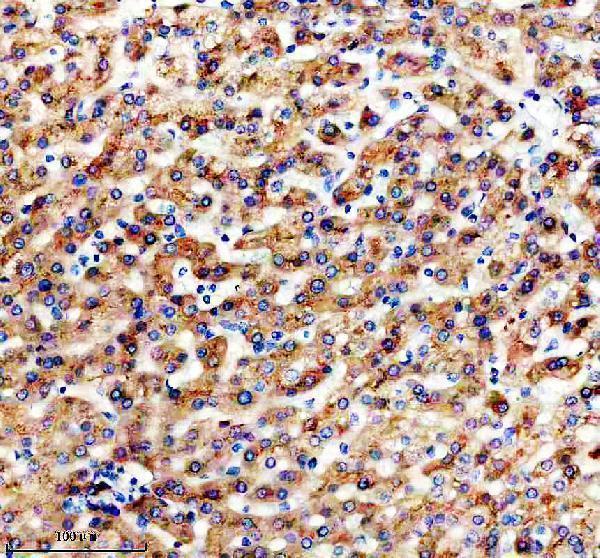 IHC analysis of APOH using anti-APOH antibody (M01998-1)