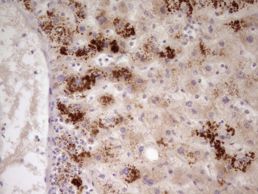 m01998 anti apolipoprotein h apoh mouse monoclonal antibody clone id oti4a11 ihc testing 4