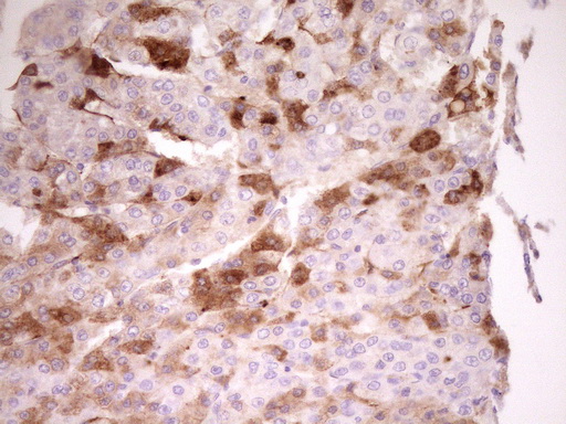 m01998 anti apolipoprotein h apoh mouse monoclonal antibody clone id oti4a11 ihc testing 5