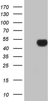 HEK293T cells were transfected with the pCMV6-ENTRY control (Left lane) or pCMV6-ENTRY APOH (Right lane) cDNA for 48 hrs and lysed
