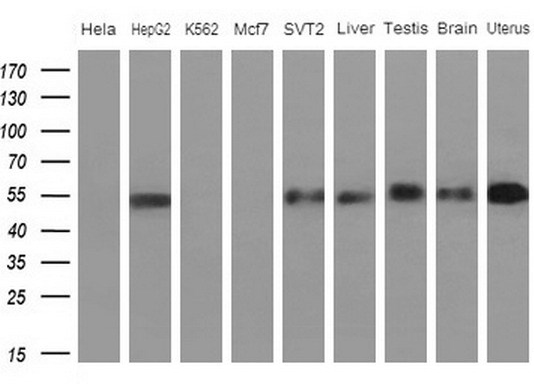 Western blot analysis of extracts (10ug) from 5 different cell lines and 4 human tissue by using anti-APOH monoclonal antibody (1: Hela; 2: HepG2; 3: K562; 4: Mcf7; 5: SVT2; 6: Liver; 7: Testis; 8: Brain; 9: Uterus) at 1:200 dilution