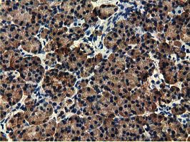 m01999 1 anti ephx2 mouse monoclonal antibody clone id oti1a6 ihc testing 3