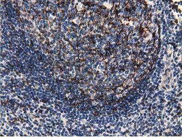 m01999 1 anti ephx2 mouse monoclonal antibody clone id oti1a6 ihc testing 7