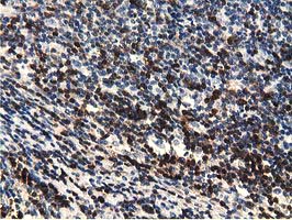 m01999 1 anti ephx2 mouse monoclonal antibody clone id oti1a6 ihc testing 8