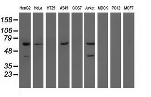 m01999 1 anti ephx2 mouse monoclonal antibody clone id oti1a6 wb testing 2