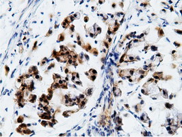 m01999 2 anti ephx2 mouse monoclonal antibody clone id oti1h5 ihc testing 11