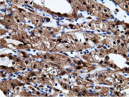 m01999 2 anti ephx2 mouse monoclonal antibody clone id oti1h5 ihc testing 13
