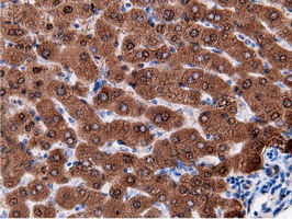 m01999 2 anti ephx2 mouse monoclonal antibody clone id oti1h5 ihc testing 14