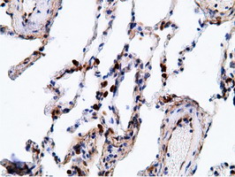 m01999 2 anti ephx2 mouse monoclonal antibody clone id oti1h5 ihc testing 15