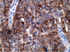 m01999 2 anti ephx2 mouse monoclonal antibody clone id oti1h5 ihc testing 4