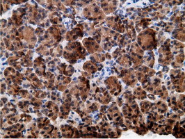 m01999 2 anti ephx2 mouse monoclonal antibody clone id oti1h5 ihc testing 5