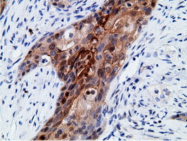 m01999 2 anti ephx2 mouse monoclonal antibody clone id oti1h5 ihc testing 6