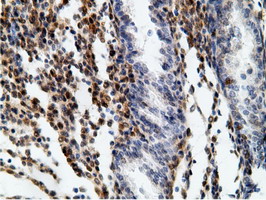 m01999 2 anti ephx2 mouse monoclonal antibody clone id oti1h5 ihc testing 8