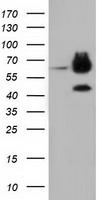 HEK293T cells were transfected with the pCMV6-ENTRY control (Left lane) or pCMV6-ENTRY EPHX2 (Right lane) cDNA for 48 hrs and lysed