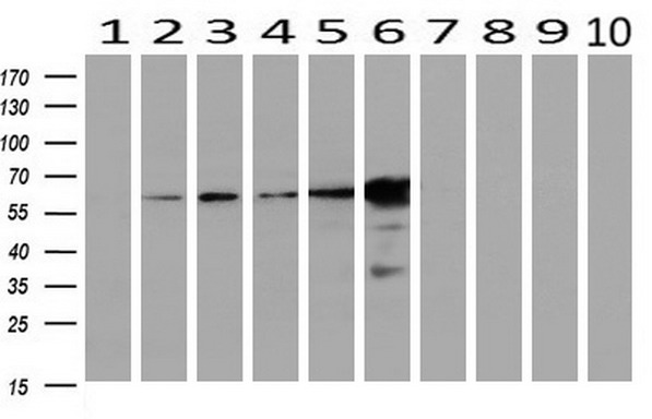 Western blot analysis of extracts (10ug) from 10 Human tissue by using anti-EPHX2 monoclonal antibody at 1:200 (1: Testis; 2: Omentum; 3: Uterus; 4: Breast; 5: Brain; 6: Liver; 7: Ovary; 8: Thyroid gland; 9: colon;10: spleen)