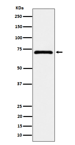 Western blot analysis of EPHX2 expression in MCF7 cell lysate