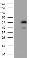HEK293T cells were transfected with the pCMV6-ENTRY control (Left lane) or pCMV6-ENTRY EPHX2 (Right lane) cDNA for 48 hrs and lysed
