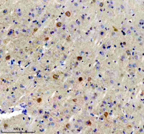IHC analysis of GAD1 using anti-GAD1 antibody (M02002)