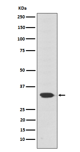 Western blot analysis of Otx2 expression in Y79 cell lysate